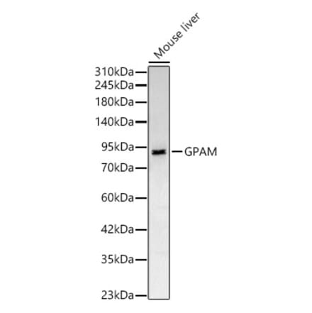 Western Blot - Anti-GPAM Antibody (A329414) - Antibodies.com