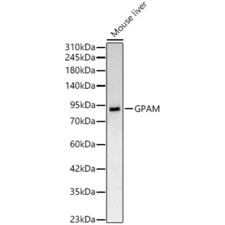 Western Blot - Anti-GPAM Antibody (A329414) - Antibodies.com
