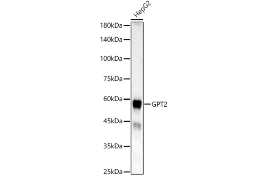 Western Blot - Anti-GPT2 Antibody (A329416) - Antibodies.com