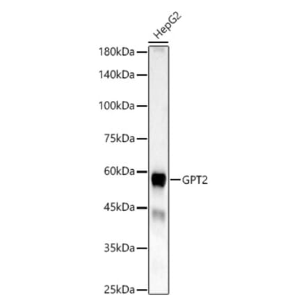 Western Blot - Anti-GPT2 Antibody (A329416) - Antibodies.com