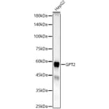 Western Blot - Anti-GPT2 Antibody (A329416) - Antibodies.com
