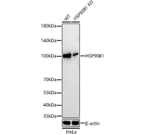 Western Blot - Anti-GRP94 Antibody [ARC60312] (A329418) - Antibodies.com