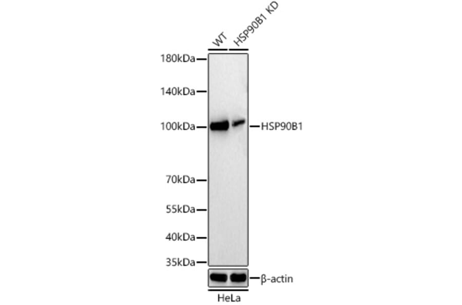 Western Blot - Anti-GRP94 Antibody [ARC60312] (A329418) - Antibodies.com
