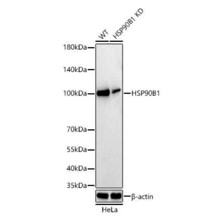 Western Blot - Anti-GRP94 Antibody [ARC60312] (A329418) - Antibodies.com