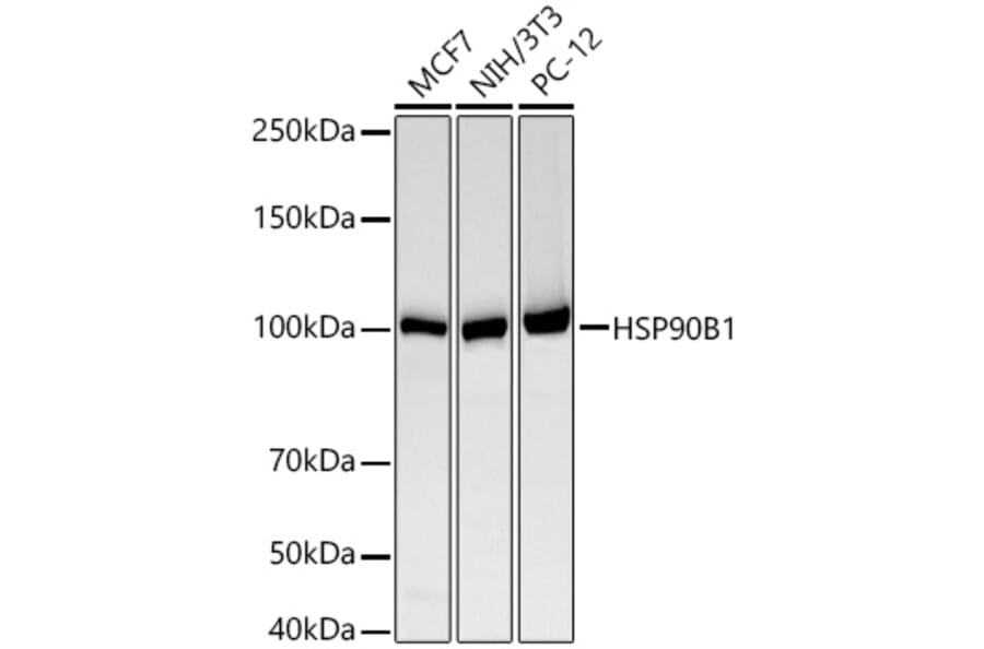 Western Blot - Anti-GRP94 Antibody [ARC60312] (A329418) - Antibodies.com