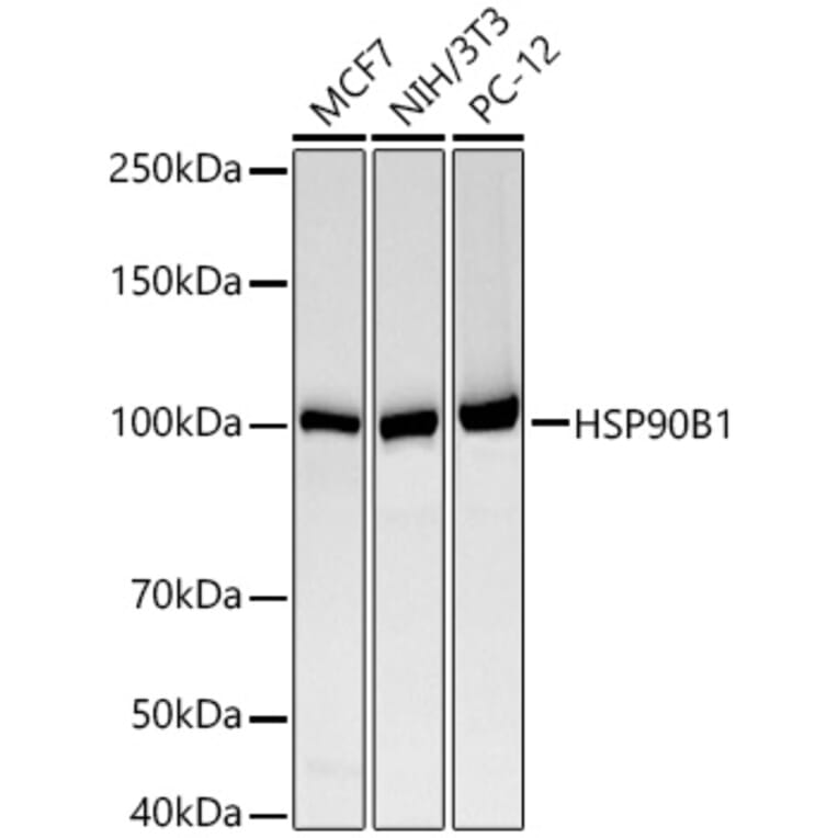Western Blot - Anti-GRP94 Antibody [ARC60312] (A329418) - Antibodies.com