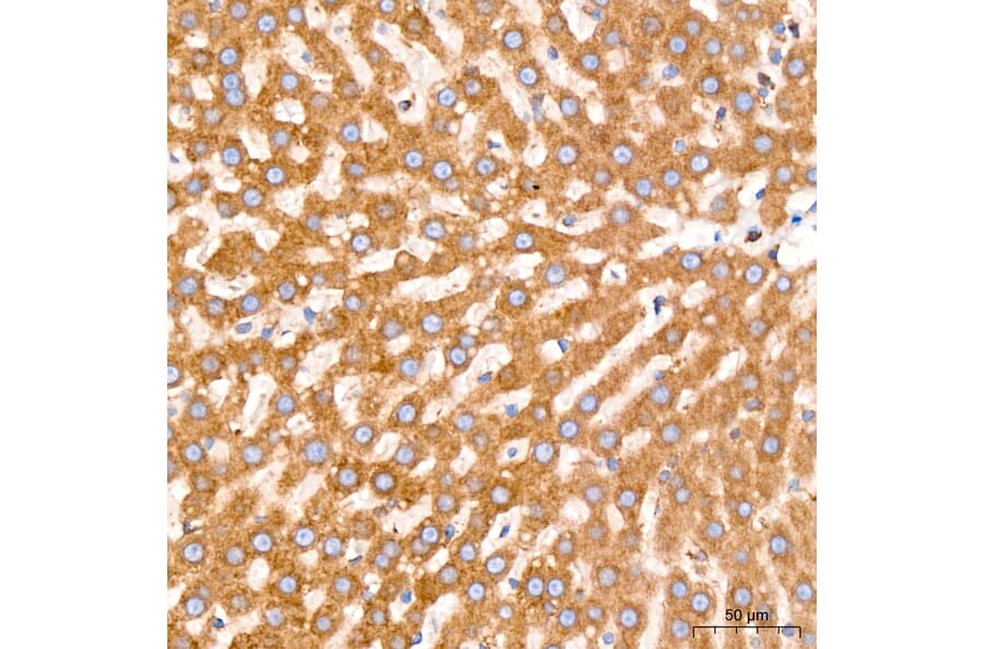 Immunohistochemistry - Anti-GRP94 Antibody [ARC60312] (A329418) - Antibodies.com