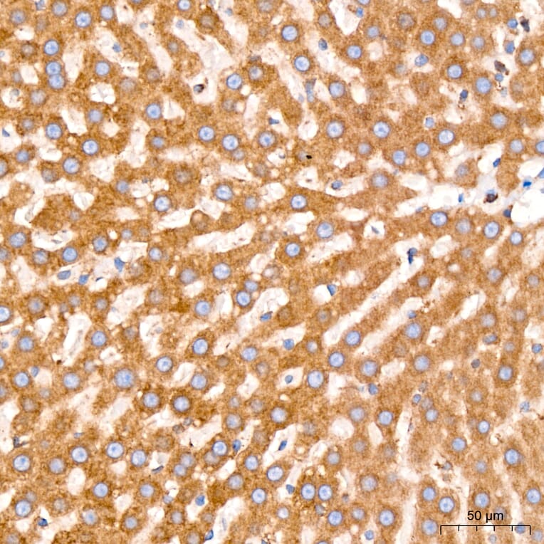 Immunohistochemistry - Anti-GRP94 Antibody [ARC60312] (A329418) - Antibodies.com