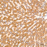 Immunohistochemistry - Anti-GRP94 Antibody [ARC60312] (A329418) - Antibodies.com