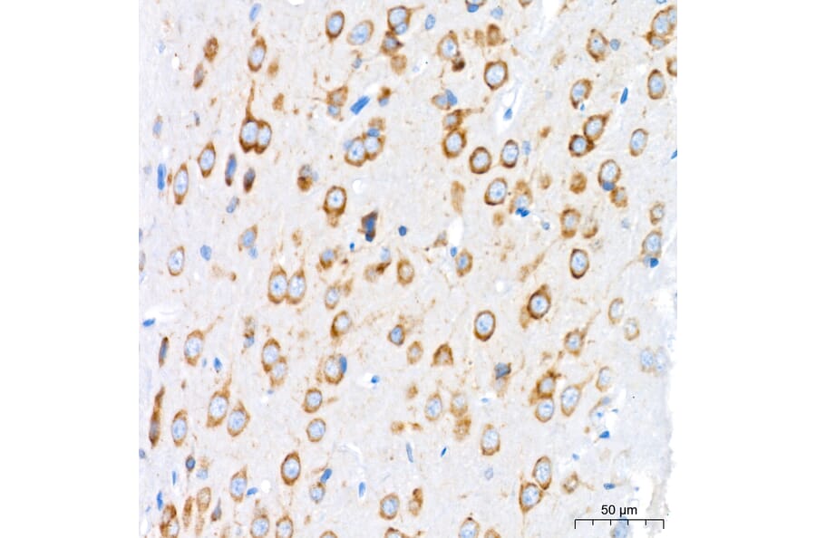 Immunohistochemistry - Anti-GRP94 Antibody [ARC60312] (A329418) - Antibodies.com