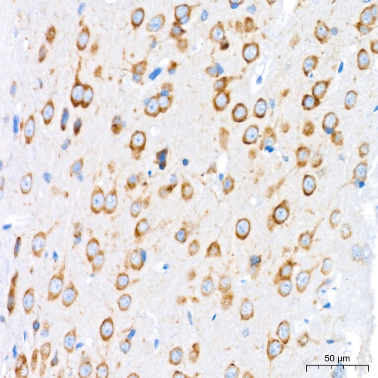Immunohistochemistry - Anti-GRP94 Antibody [ARC60312] (A329418) - Antibodies.com