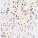 Immunohistochemistry - Anti-GRP94 Antibody [ARC60312] (A329418) - Antibodies.com