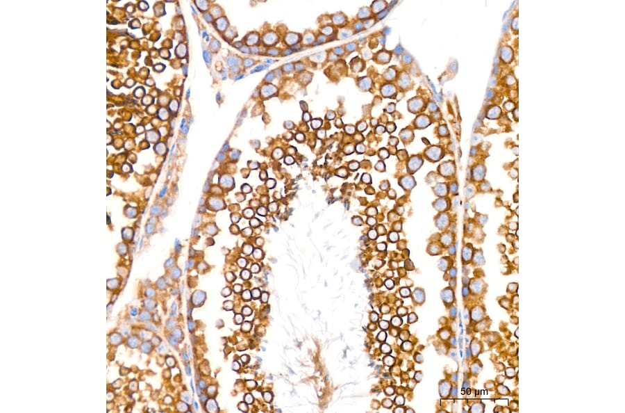 Immunohistochemistry - Anti-GRP94 Antibody [ARC60312] (A329418) - Antibodies.com