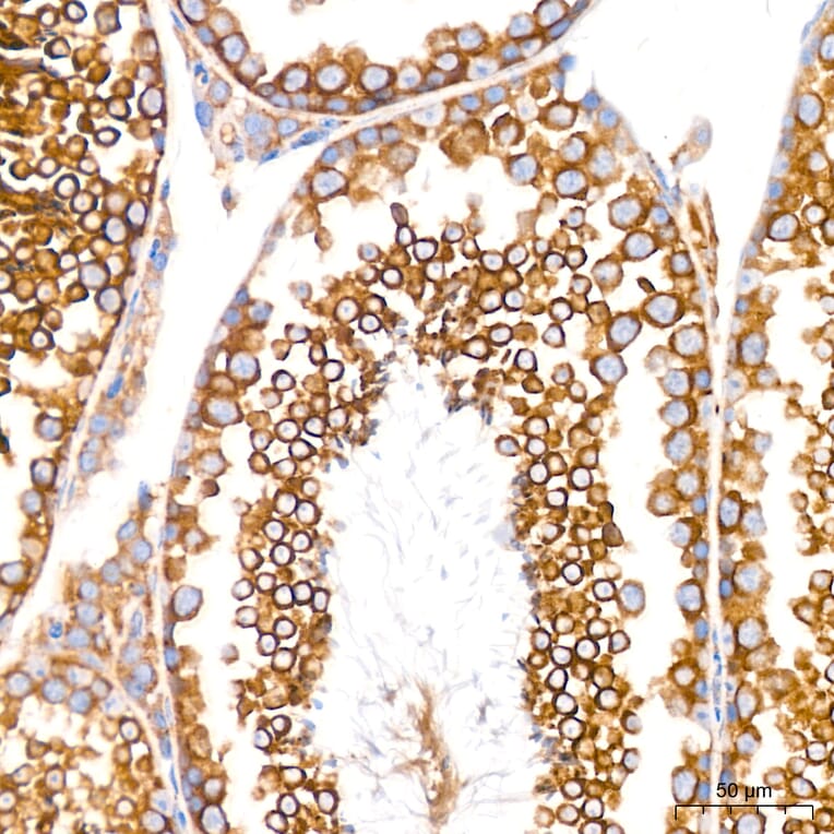 Immunohistochemistry - Anti-GRP94 Antibody [ARC60312] (A329418) - Antibodies.com