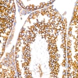 Immunohistochemistry - Anti-GRP94 Antibody [ARC60312] (A329418) - Antibodies.com