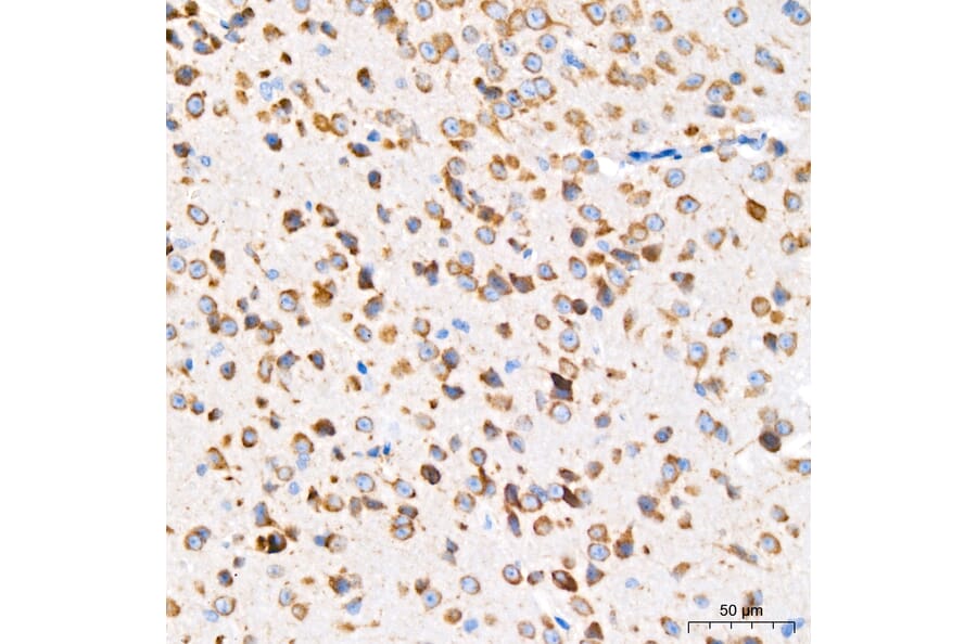 Immunohistochemistry - Anti-GRP94 Antibody [ARC60312] (A329418) - Antibodies.com