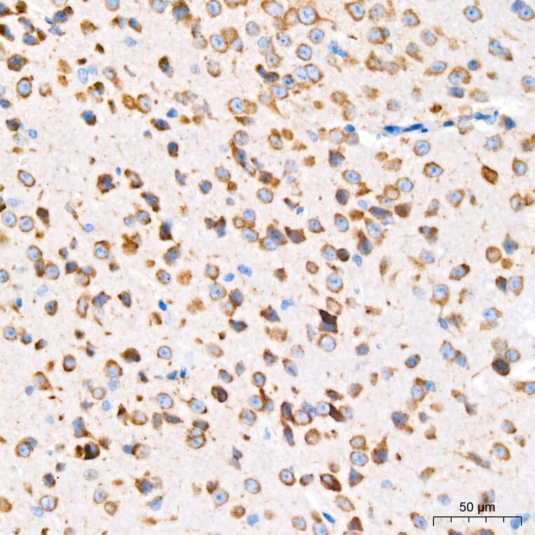 Immunohistochemistry - Anti-GRP94 Antibody [ARC60312] (A329418) - Antibodies.com
