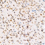 Immunohistochemistry - Anti-GRP94 Antibody [ARC60312] (A329418) - Antibodies.com