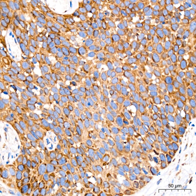 Immunohistochemistry - Anti-GRP94 Antibody [ARC60312] (A329418) - Antibodies.com