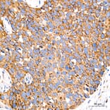 Immunohistochemistry - Anti-GRP94 Antibody [ARC60312] (A329418) - Antibodies.com