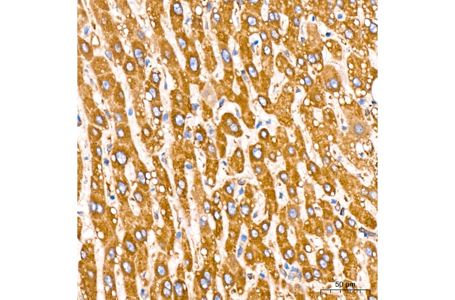 Immunohistochemistry - Anti-GRP94 Antibody [ARC60312] (A329418) - Antibodies.com