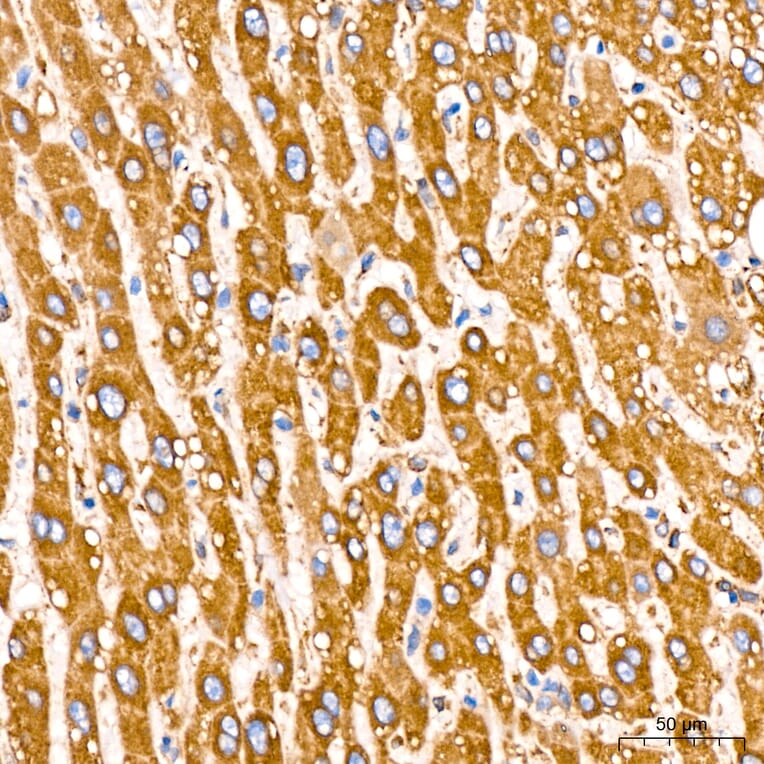 Immunohistochemistry - Anti-GRP94 Antibody [ARC60312] (A329418) - Antibodies.com