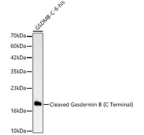 Western Blot - Anti-GSDMB Antibody [ARC63400] (A329419) - Antibodies.com