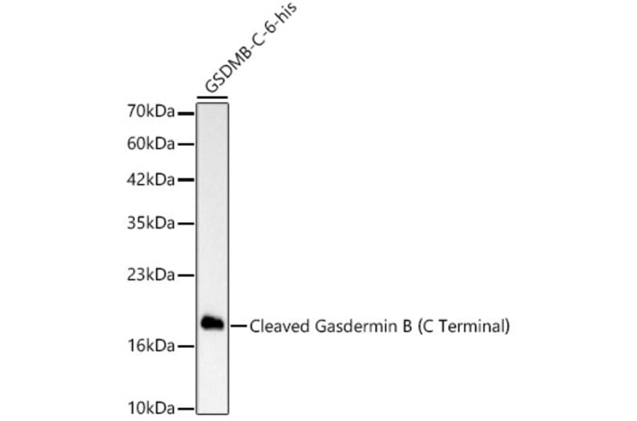 Western Blot - Anti-GSDMB Antibody [ARC63400] (A329419) - Antibodies.com