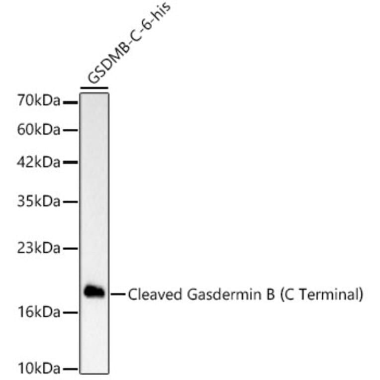 Western Blot - Anti-GSDMB Antibody [ARC63400] (A329419) - Antibodies.com