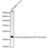 Western Blot - Anti-GSDMB Antibody [ARC63400] (A329419) - Antibodies.com