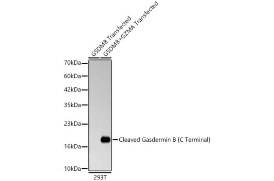 Western Blot - Anti-GSDMB Antibody [ARC63400] (A329419) - Antibodies.com