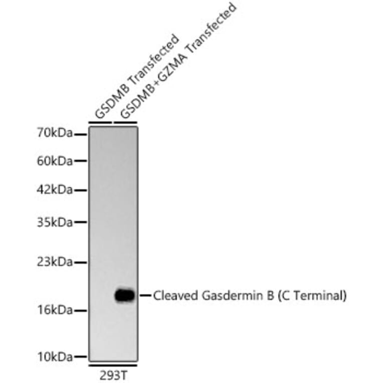Western Blot - Anti-GSDMB Antibody [ARC63400] (A329419) - Antibodies.com