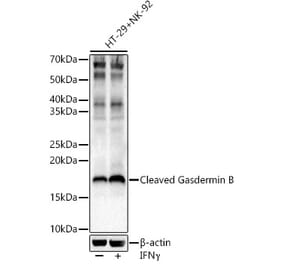 Western Blot - Anti-GSDMB Antibody (A329420) - Antibodies.com