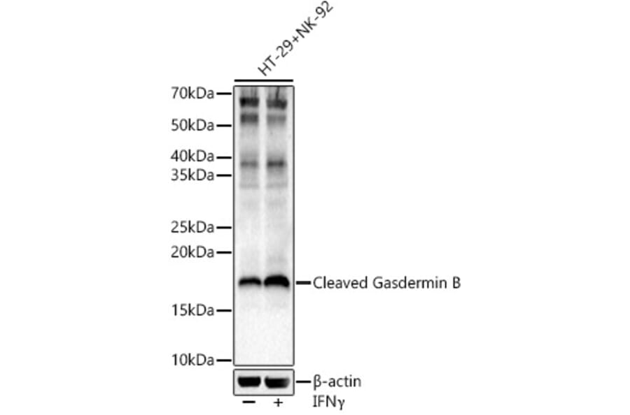 Western Blot - Anti-GSDMB Antibody (A329420) - Antibodies.com