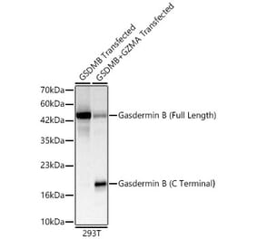 Western Blot - Anti-GSDMB Antibody (A329421) - Antibodies.com