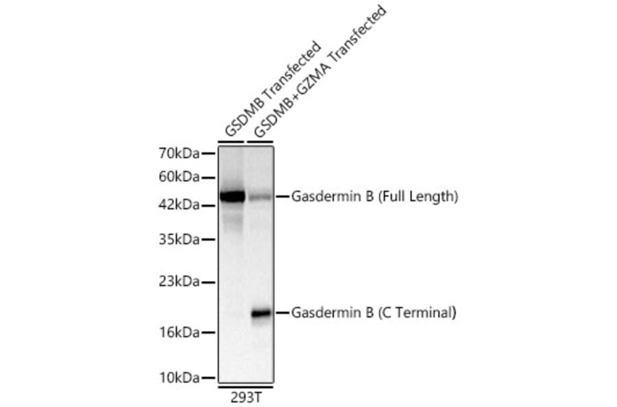 Western Blot - Anti-GSDMB Antibody (A329421) - Antibodies.com