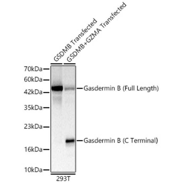 Western Blot - Anti-GSDMB Antibody (A329421) - Antibodies.com