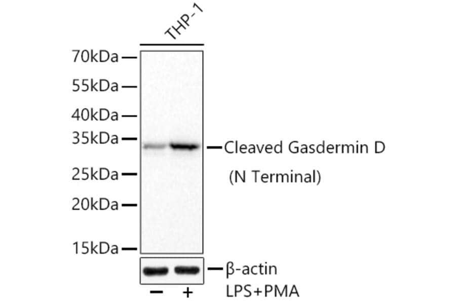 Western Blot - Anti-GSDMD Antibody [ARC57989] (A329422) - Antibodies.com