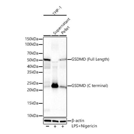 Western Blot - Anti-GSDMD Antibody [ARC61812] (A329423) - Antibodies.com