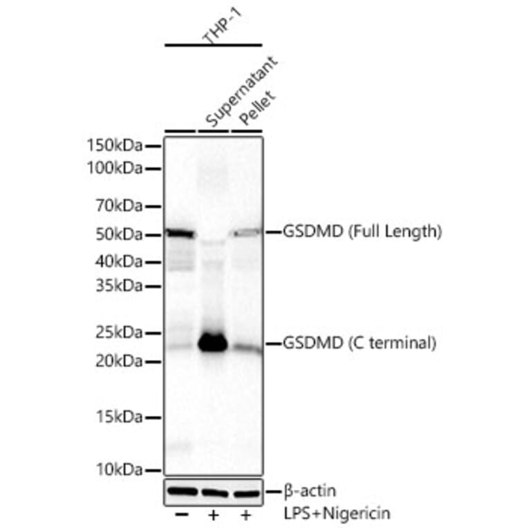 Western Blot - Anti-GSDMD Antibody [ARC61812] (A329423) - Antibodies.com