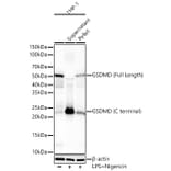 Western Blot - Anti-GSDMD Antibody [ARC61812] (A329423) - Antibodies.com