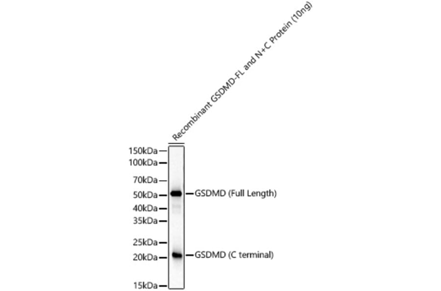 Western Blot - Anti-GSDMD Antibody [ARC61812] (A329423) - Antibodies.com