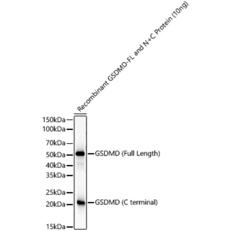 Western Blot - Anti-GSDMD Antibody [ARC61812] (A329423) - Antibodies.com