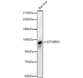Western Blot - Anti-GTF2IRD1 Antibody (A329425) - Antibodies.com