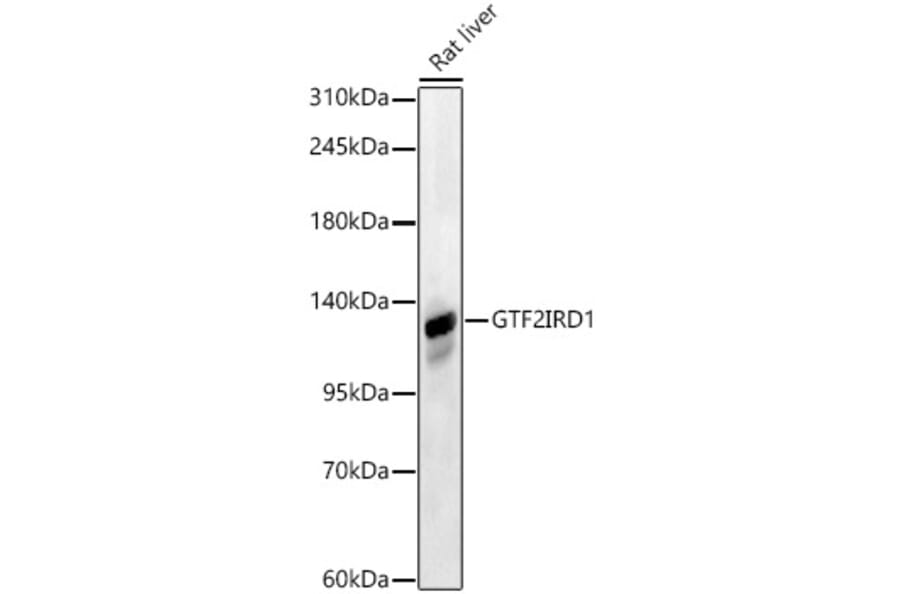 Western Blot - Anti-GTF2IRD1 Antibody (A329425) - Antibodies.com