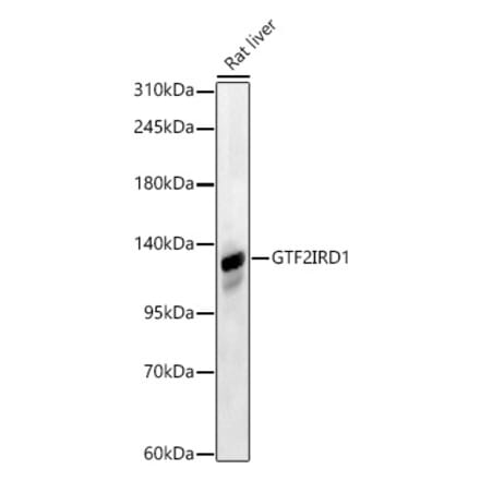 Western Blot - Anti-GTF2IRD1 Antibody (A329425) - Antibodies.com