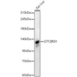 Western Blot - Anti-GTF2IRD1 Antibody (A329425) - Antibodies.com
