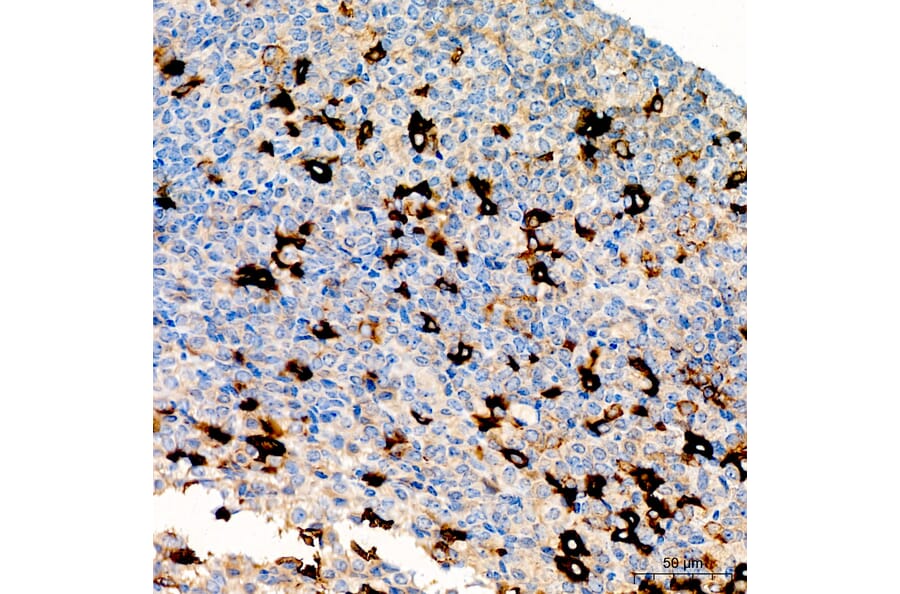 Immunohistochemistry - Anti-HCG alpha Antibody (A329426) - Antibodies.com