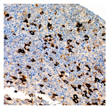 Immunohistochemistry - Anti-HCG alpha Antibody (A329426) - Antibodies.com