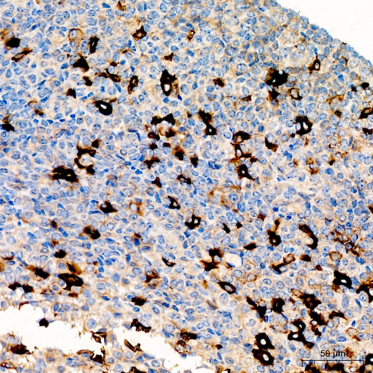 Immunohistochemistry - Anti-HCG alpha Antibody (A329426) - Antibodies.com